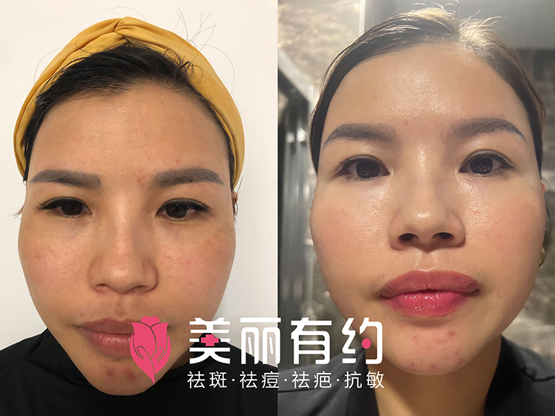 修復中心