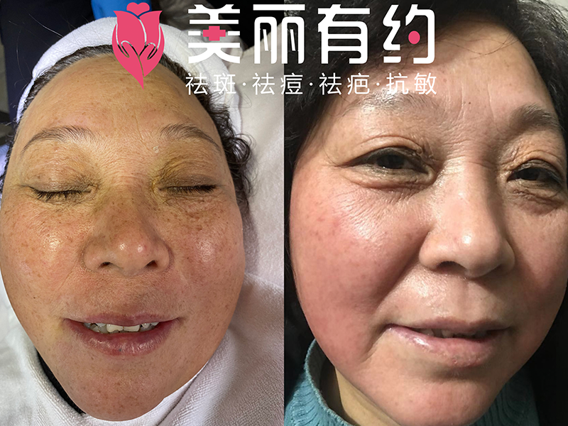 修復中心