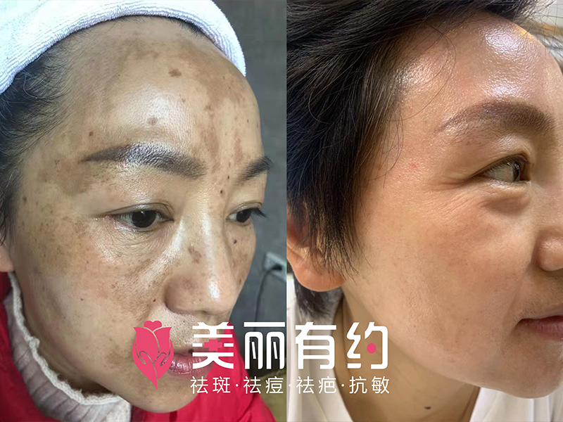 修復中心