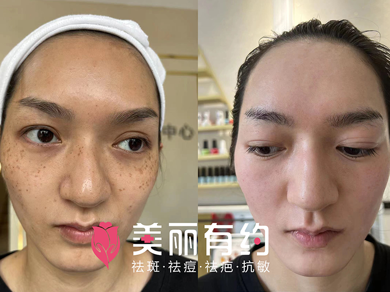 修復中心