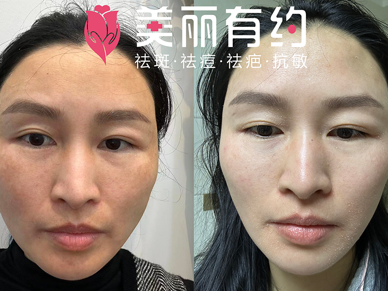 修復中心