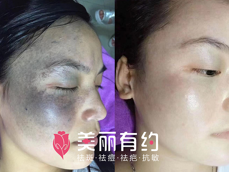 修復中心