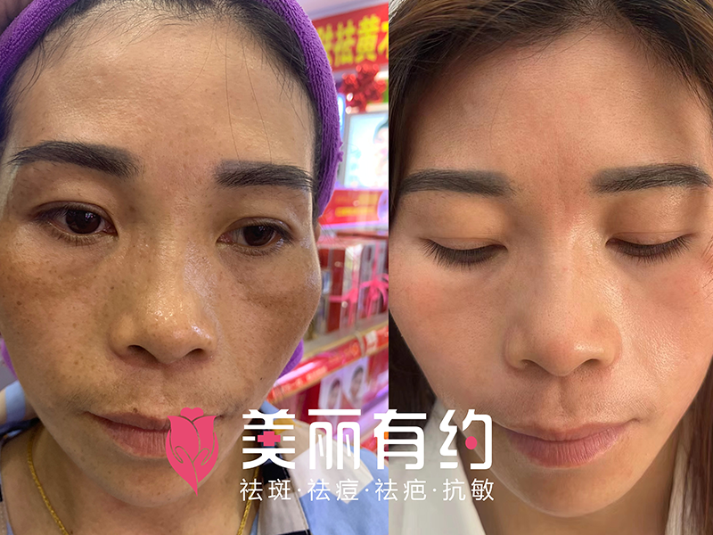 修復中心